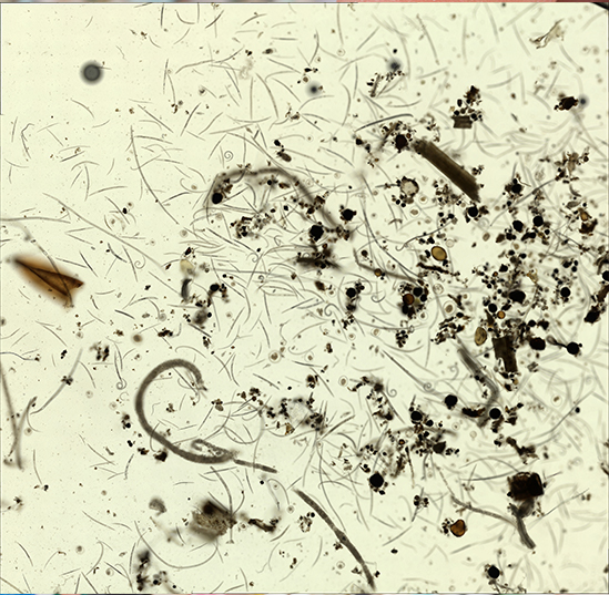 Nematodes, as seen under a microscope in one our labs.