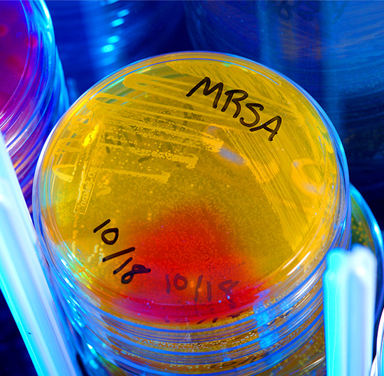 Scientists grow methicillin-resistant Staphylococcus aureus, or MRSA, bacteria in a petri dish. CDC/Melissa Dankel. Photo by James Gathany.