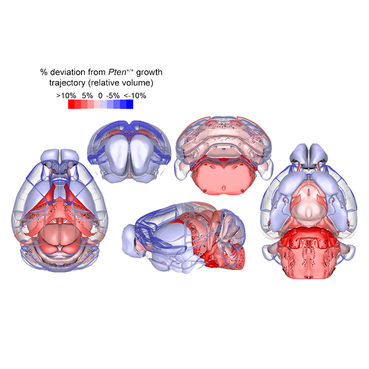 Study reveals previously unknown autism-related behavioral deficit