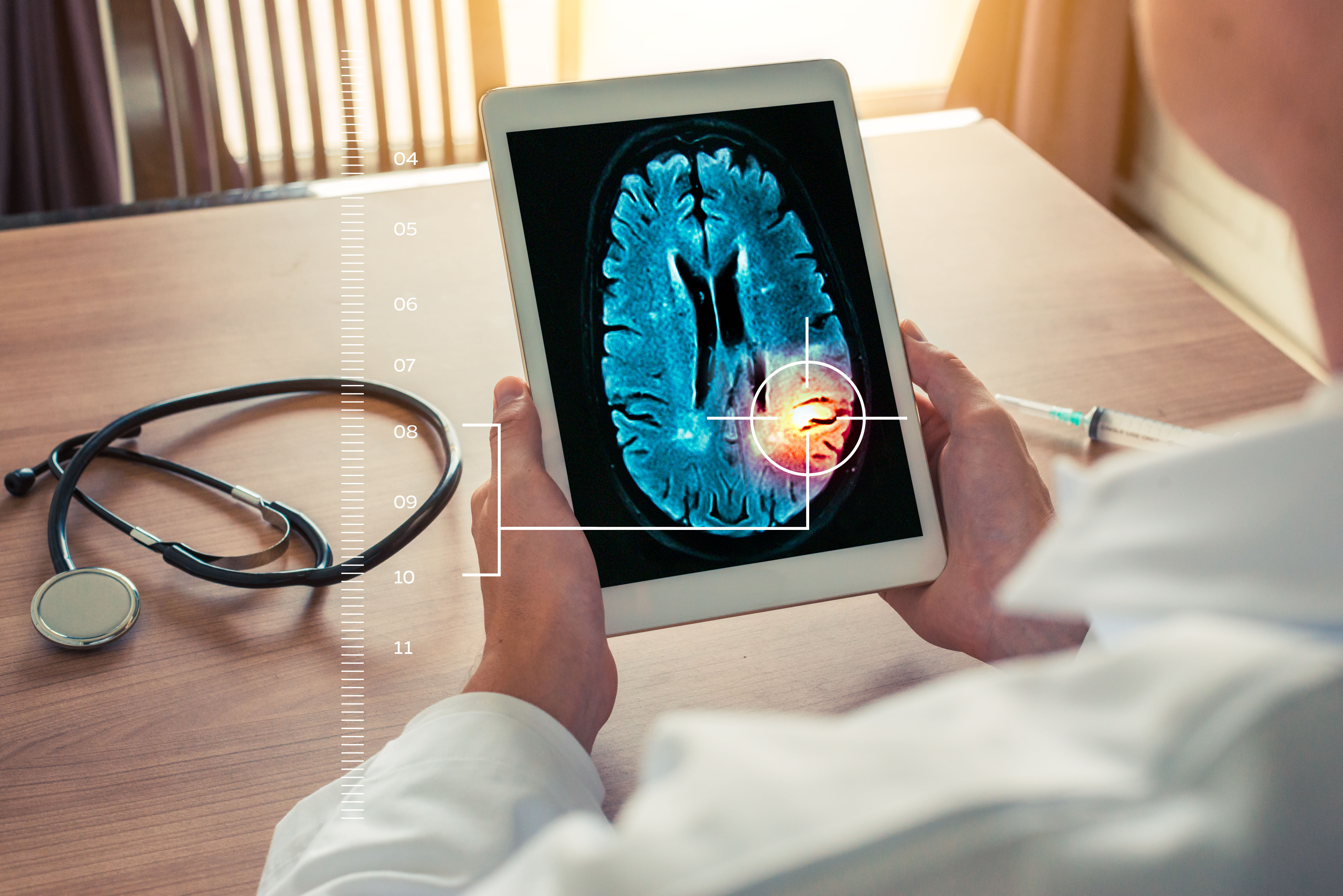 A doctor holds a tablet with a brain scan on it. 