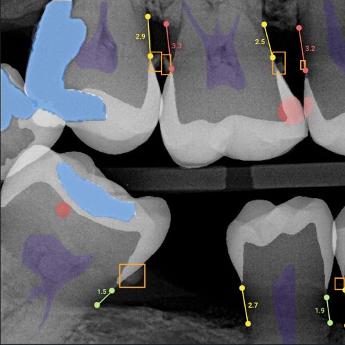 Students hone their dental AI skills while helping their patients