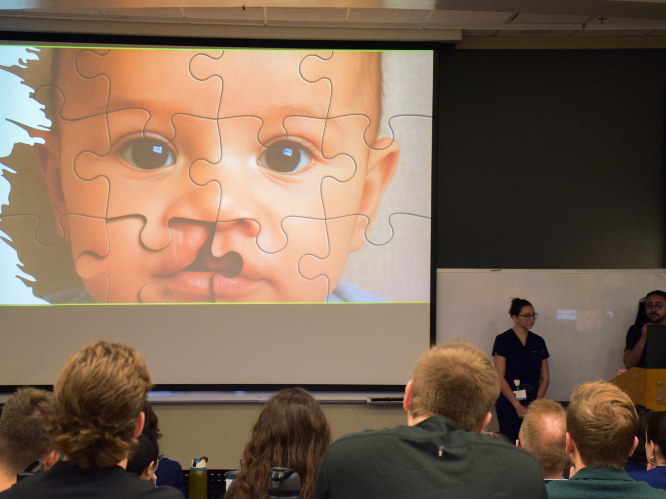 Jonathan Sorsok, D.M.D., uses a jigsaw puzzle analogy to explain how a cleft lip or palate occurs